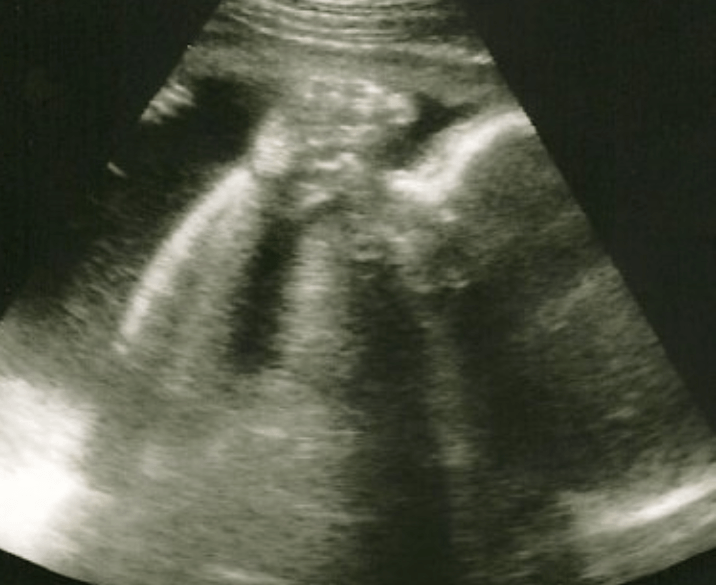 When Does Life Begin?  Life Begins at the Beginning. (A Doctor Gives the Scientific Facts on When Life Begins) Part I of III